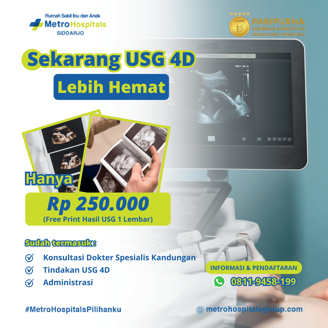 Promo USG 4D