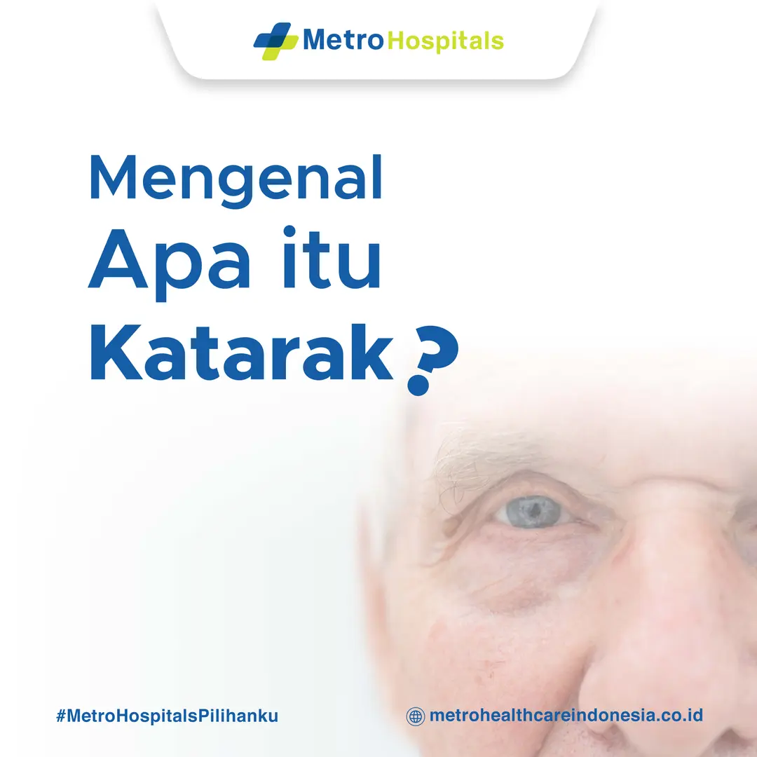 Mengenal Apa Itu Katarak