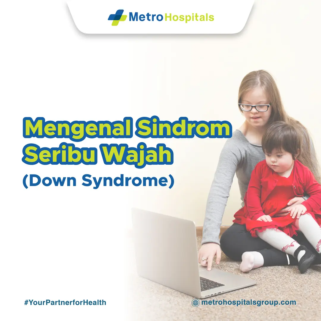 Mengenal Sindrom Seribu Wajah (Down Syndrome)